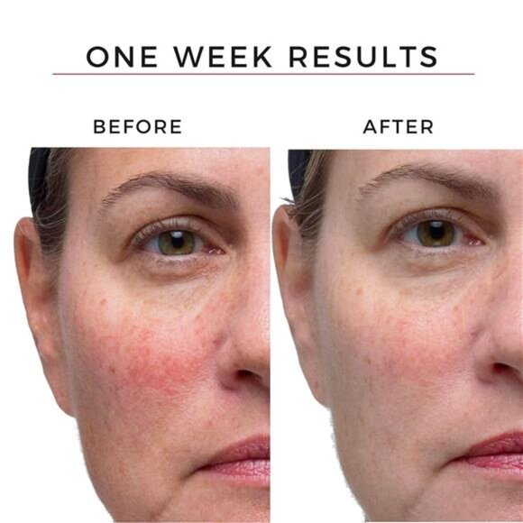 Honey Silk Facial Serum | Anti-Aging Vitamin C & Acid Serum for Radiant Skin 1oz - Picture 2 of 6